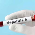 यूपी में हेपेटाइटिस ए का बड़ा खतरा, 97% सैंपल पॉजिटिव मिले
