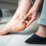 नए जूतों के छालों से राहत देंगे ये घरेलू नुस्खे, दर्द होगा दूर